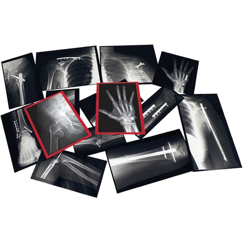 Radiographies des os fixes Roylco