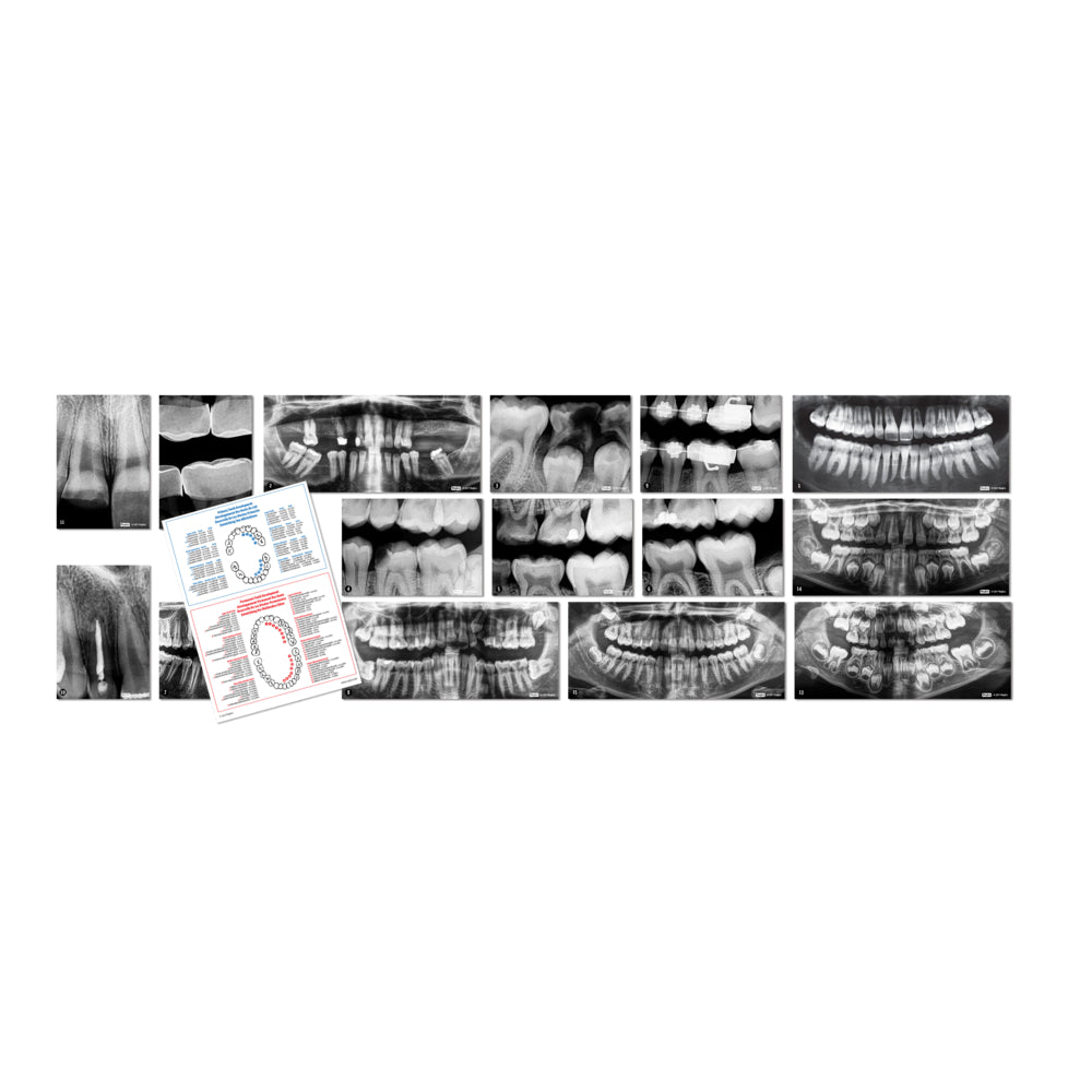 Radiographies dentaires Roylco